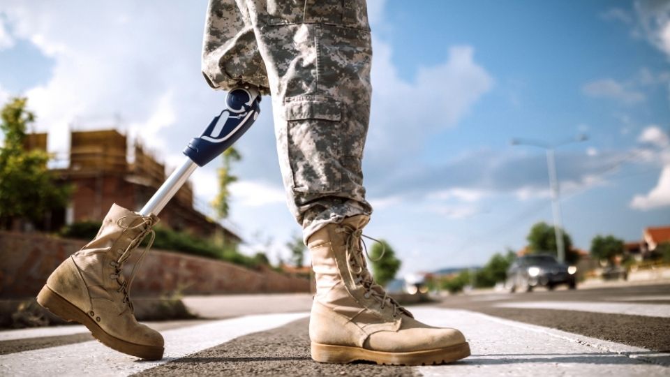 prosthetics-services-okc solider prosthetics service